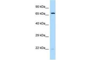 Image no. 1 for anti-Sorcin (SRI) (C-Term) antibody (ABIN6747972) (SRI antibody  (C-Term))