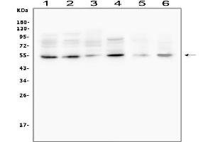 Western blot analysis of MMP13 using anti-MMP13 antibody (ABIN5693125).