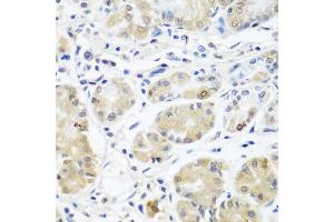Immunohistochemistry of paraffin-embedded human stomach using EIF3A antibody at dilution of 1:100 (40x lens). (EIF3A antibody)