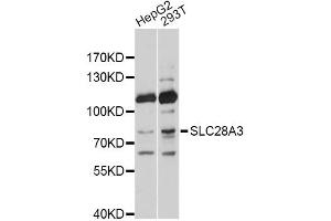 Western blot analysis of extracts of various cell lines, using SLC28A3 antibody. (SLC28A3 antibody)