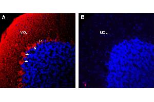 Expression of Semaphorin 6A in rat cerebellum.