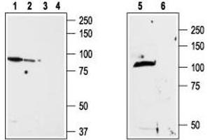 Western blot analysis of ND7/23 cell line membrane (lanes 1 and 3), RBL lysates (lanes 2 and 4) and rat brain membrane (lanes 5and 6): - 1,2,5. (TRPV2 antibody  (1st Extracellular Loop))