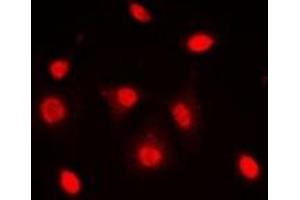 Immunofluorescent analysis of Dyskerin staining in MCF7 cells. (DKC1 antibody)
