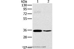 Western blot analysis of 293T and skov3 cell, using OTUB1 Polyclonal Antibody at dilution of 1:570