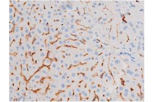 ABIN6267486 at 1/200 staining Mouse liver tissue sections by IHC-P.