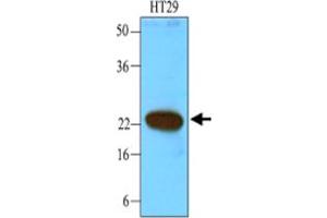 Western blot analysis of cell lysates of HT-29 (40 ug) were resolved by SDS - PAGE , transferred to NC membrane and probed with CIB1 monoclonal antibody , clone 1D1 (1 : 1000) .