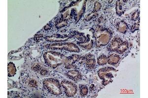 ENPP3 antibody  (Internal Region)