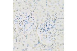 Immunohistochemistry of paraffin-embedded rat kidney using KAT2A antibody. (KAT2A antibody)