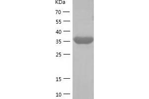 Western Blotting (WB) image for Activating Transcription Factor 4 (Tax-Responsive Enhancer Element B67) (ATF4) (AA 1-351) protein (His tag) (ABIN7285551) (ATF4 Protein (AA 1-351) (His tag))