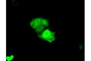 Anti-KHK mouse monoclonal antibody (ABIN2453194) immunofluorescent staining of COS7 cells transiently transfected by pCMV6-ENTRY KHK (RC202424). (Ketohexokinase antibody)