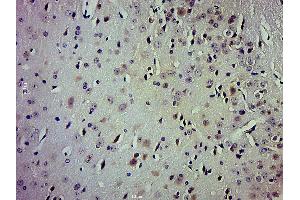 Paraformaldehyde-fixed, paraffin embedded mouse brain; Antigen retrieval by boiling in sodium citrate buffer (pH6. (TrkA, B, C (pTyr516) antibody)