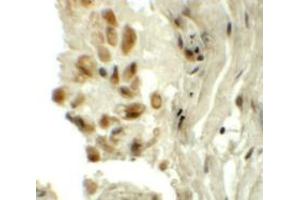 Immunohistochemistry (IHC) image for anti-tRNA-YW Synthesizing Protein 1 Homolog (TYW1) (C-Term) antibody (ABIN1030788) (TYW1 antibody  (C-Term))