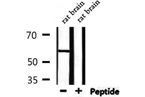 Western blot analysis of extracts from rat brain, using USP30 Antibody. (Usp30 antibody  (N-Term))