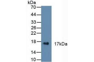 Detection of CST6 in Human Urine using Polyclonal Antibody to Cystatin 6 (CST6) (CST6 antibody  (AA 29-149))