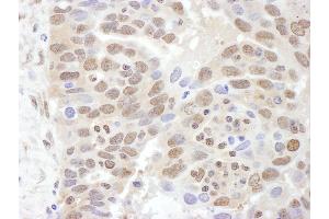 anti-Proteasome (Prosome, Macropain) 26S Subunit, ATPase, 2 (PSMC2) (AA 150-200) antibody