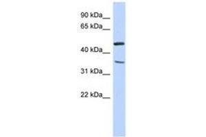 Image no. 1 for anti-Family with Sequence Similarity 81, Member B (FAM81B) (N-Term) antibody (ABIN6741214) (FAM81B antibody  (N-Term))