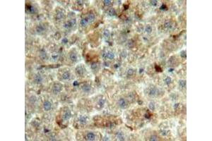 Used in DAB staining on fromalin fixed paraffin-embedded Liver tissue (GDF2 antibody  (AA 22-178))