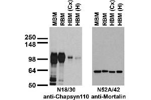 Immunoblot against crude membranes from whole adult mouse brain (MBM) or rat brain (RBM) and from human cerebral cortex [HBM(Cx)] or hippocampus [HBM(H)] probed with N18/30 (left) or N52A/42 (right) TC supe.