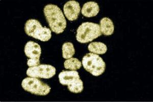 Immunofluorescence staining of SK-N-MC (Human neuroblastoma, ATCC HTB-10). (CTBP2 antibody  (AA 361-445))