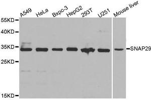 Western blot analysis of extracts of Jurkat cell line, using SNAP29 antibody. (SNAP29 antibody  (AA 1-258))