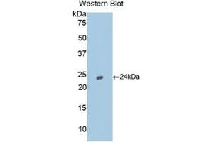 Western blot analysis of the recombinant protein. (Caspase 9 antibody  (AA 1-200))