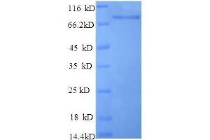 Heterogeneous Nuclear Ribonucleoprotein K (HNRNPK) (AA 3-459), (partial) protein (GST tag) (HNRNPK Protein (AA 3-459, partial) (GST tag))