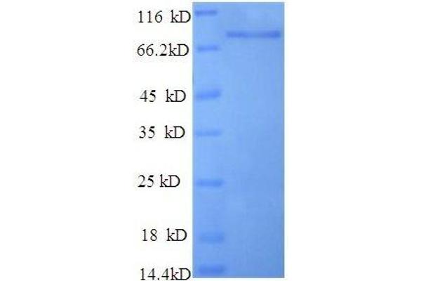 HNRNPK Protein (AA 3-459, partial) (GST tag)