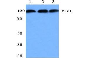 Western blot analysis of CD117/c-Kit antibody at 1/500 dilution in: Lane 1: MCF-7 cell lysate. (KIT antibody)