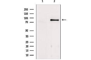 Western blot analysis of extracts from mouse brain, using TACC1 Antibody.