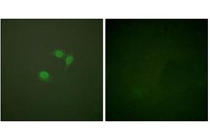 Immunofluorescence analysis of NIH/3T3 cells, using Sumo1 antibody.
