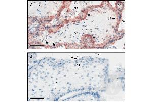 Immunohistochemistry (Paraffin-embedded Sections) (IHC (p)) image for anti-CD200 Receptor 1-Like (CD200R1L) (AA 151-250) antibody (ABIN1715098)