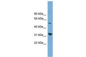 Image no. 1 for anti-Yip1 Domain Family, Member 2 (YIPF2) (AA 141-190) antibody (ABIN6745545) (YIPF2 antibody  (AA 141-190))