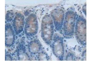 Detection of CEACAM1 in Rat Intestine Tissue using Polyclonal Antibody to Carcinoembryonic Antigen Related Cell Adhesion Molecule 1 (CEACAM1) (CEACAM1 antibody  (AA 36-145))