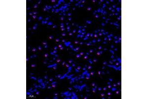 Immunofluorescence analysis of paraffin embedded rat kidney using TIP49A (ABIN7075488) at dilution of 1: 300 (RUVBL1 antibody)