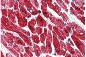 Human Heart (formalin-fixed, paraffin-embedded) stained with TNNI3 antibody ABIN334276 at 2. (TNNI3 antibody)