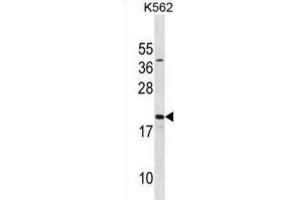 Western Blotting (WB) image for anti-Activated RNA Polymerase II Transcriptional Coactivator p15 (SUB1) antibody (ABIN3001149) (SUB1 antibody)