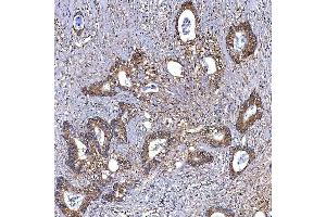 IHC analysis of TRMT2B using anti-TRMT2B antibody (ABIN7599456). (TRMT2B antibody  (AA 1-504))