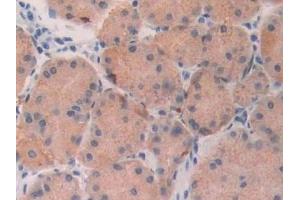 Immunohistochemistry (IHC) image for anti-Fibroblast Growth Factor 19 (FGF19) (AA 4-216) antibody (ABIN7440947)