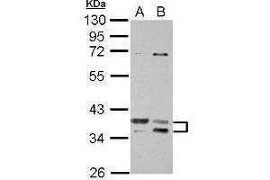 WB Image Sample (30 ug of whole cell lysate) A: Jurkat B: K562 10% SDS PAGE antibody diluted at 1:1000 (TSFM antibody)