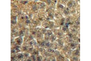 #VALUE! (ITIH2 antibody  (AA 452-702))