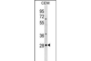 ALKBH4 Antibody (Center) (ABIN656701 and ABIN2845934) western blot analysis in CEM cell line lysates (35 μg/lane). (ALKBH4 antibody  (AA 88-117))