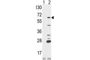 Western Blotting (WB) image for anti-Protein-tyrosine Phosphatase 1C (PTPN6) antibody (ABIN3001647)