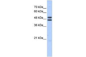 WB Suggested Anti-ERCC8 Antibody Titration: 0. (ERCC8 antibody  (Middle Region))