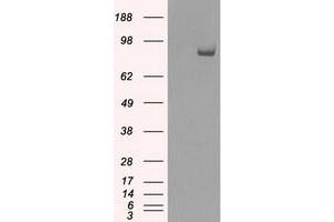Western Blotting (WB) image for anti-SATB Homeobox 1 (SATB1) antibody (ABIN1500812) (SATB1 antibody)