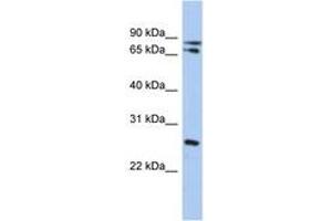 Image no. 1 for anti-Ovo-Like 2 (OVOL2) (C-Term) antibody (ABIN6742352)