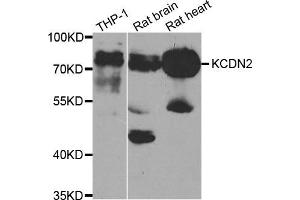 Western Blotting (WB) image for anti-Potassium Voltage-Gated Channel, Shal-Related Subfamily, Member 2 (KCND2) antibody (ABIN1882330) (KCND2 antibody)