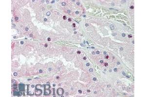 ABIN308427 (3. (HOXD10 antibody  (Internal Region))