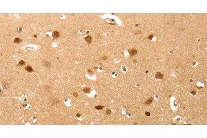 Immunohistochemistry of paraffin-embedded Human brain tissue using TNN Polyclonal Antibody at dilution 1:40 (Tenascin N antibody)