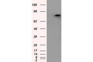 Image no. 1 for anti-Amyloid beta (A4) Precursor Protein (APP) antibody (ABIN1496880)