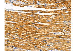 Phospho-SIK2 (Ser358) Antibody at 1/100 staining Rat heart tissue by IHC-P.